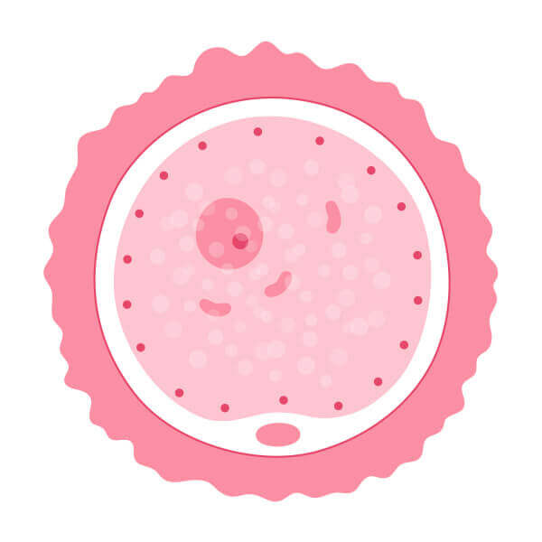 Granocyte - IVF method